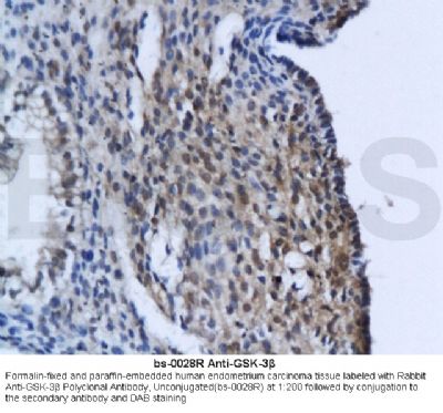 GSK-3 Beta糖原合酶激酶-3β抗体