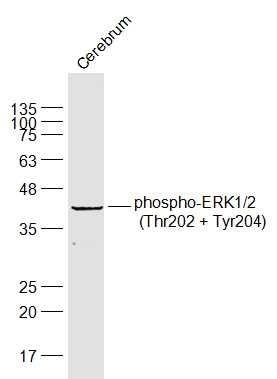 phospho-ERK1/2 (Thr202 + Tyr20
