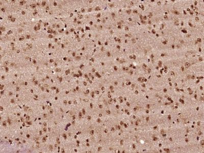 hnRNP A2B1异质核糖核蛋白hnRNPA2抗体