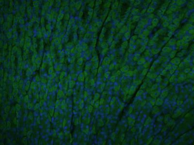 Calreticulin钙网蛋白抗体