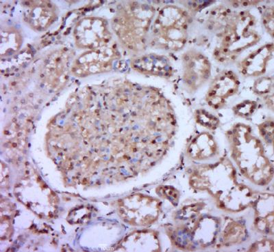 ZNF804B锌指蛋白804B抗体