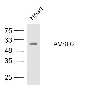 AVSD2富含半胱氨酸与表皮生长因子样蛋白2抗体