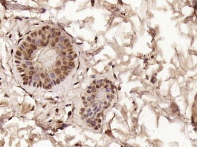 phospho-CK18(Ser52)磷酸化细胞角蛋白18抗