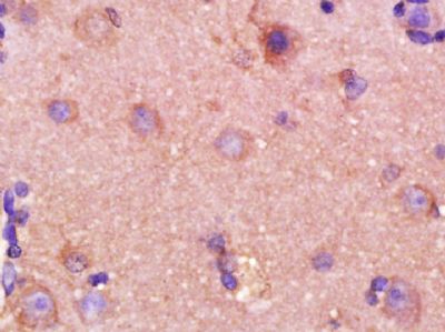 MMP2基质金属蛋白酶2单克隆抗体