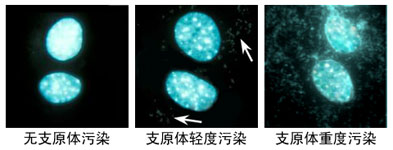 PI3K抑制剂(LY294002)厂家