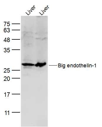 Big endothelin-1 antibody