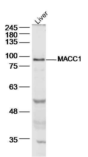 MACC1 antibody