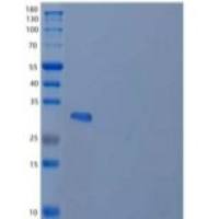 人Carbonic Anhydrase 3/CA3重组蛋白C-6His