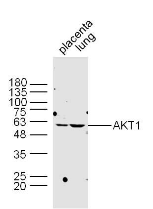AKT1蛋白激酶B抗体