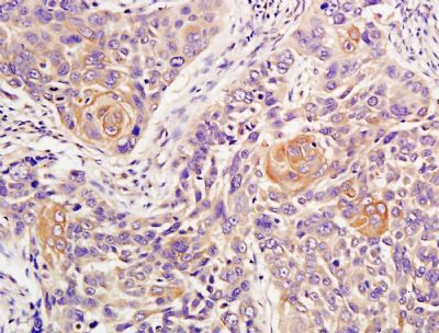 ATM毛细血管扩张性共济失调症突变蛋白抗体