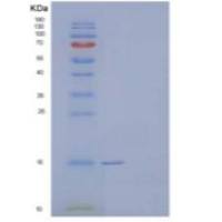 人血红蛋白亚单位α/hba1c重组蛋白N-6His