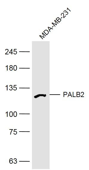 PALB2乳腺癌易感基因相关蛋白2