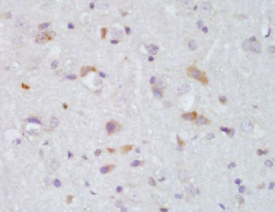 Catalase过氧化氢酶抗体