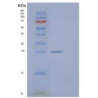 人Serpin B5/SERPINB5/Maspin重组蛋白