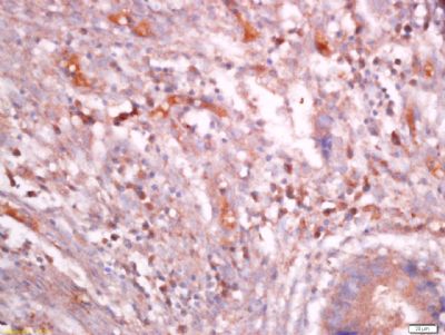 Cardiac Troponin T心肌特异性肌钙蛋白T抗体
