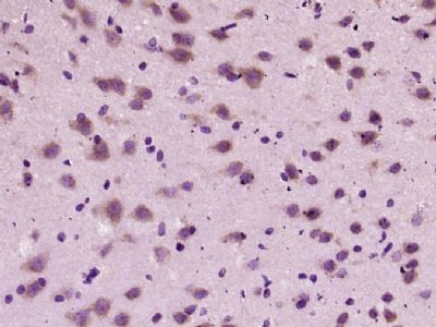 phospho-Tau (Ser356)磷酸化微管相关蛋白抗