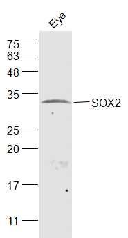 SOX2胚胎干细胞关键蛋白抗体