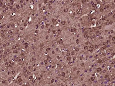 Tissue factor/CD142 antibody