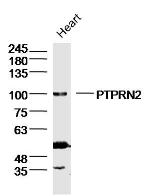 PTPRN2胰岛细胞自身抗原相关蛋白PTPRN2抗体