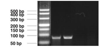 猪传染性胸膜肺炎放线杆菌单重凝胶PCR检测试剂盒