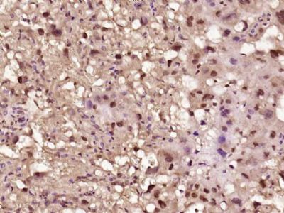 LTV1/C6orf93 antibody