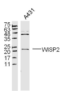 WISP2 antibody