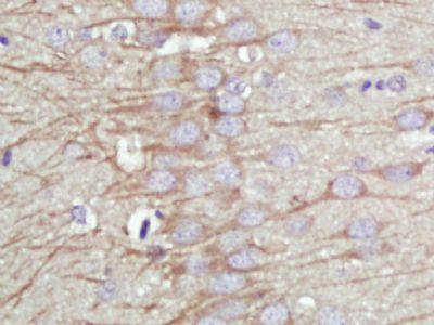 KCNMA1/BK channel antibody