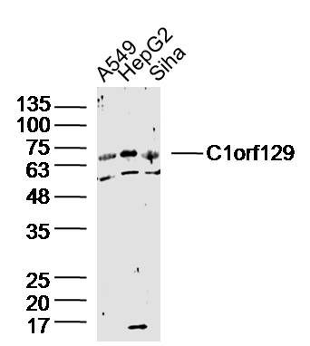 C1orf129 1号染色体开放阅读框129抗体