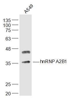 hnRNP A2B1异质核糖核蛋白hnRNPA2抗体