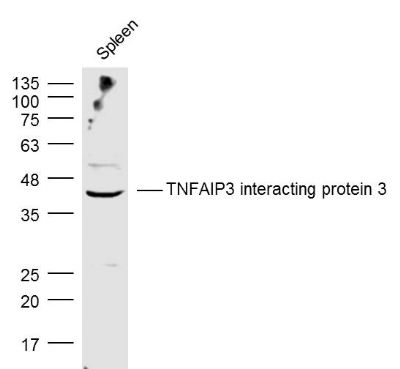 TNFAIP3 interacting protein 3肿