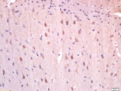 GAD65谷氨酸脱羧酶-65抗体