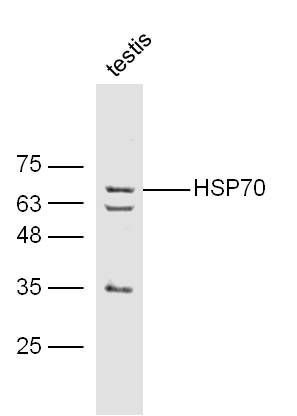 HSP70热休克蛋白-70抗体