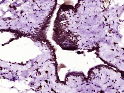 FABP4脂肪细胞型脂肪酸结合蛋白