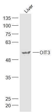 OIT3癌蛋白诱导转录因子3抗体