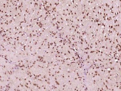 phospho-Src (Ser75) antibody