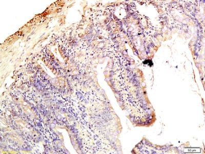 Claudin 1紧密连接蛋白1抗体