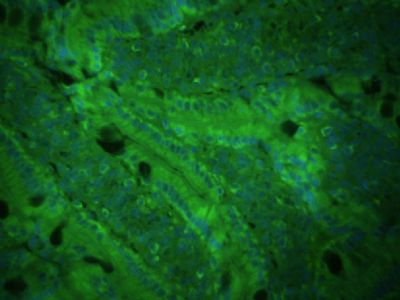 CXCL16 CXC趋化因子16抗体