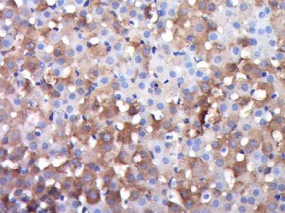 DGKK甘油二酯激酶κ/DGK-κ抗体