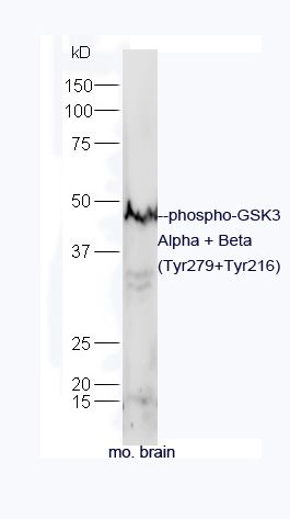 phospho-GSK3 Alpha + Beta (Tyr