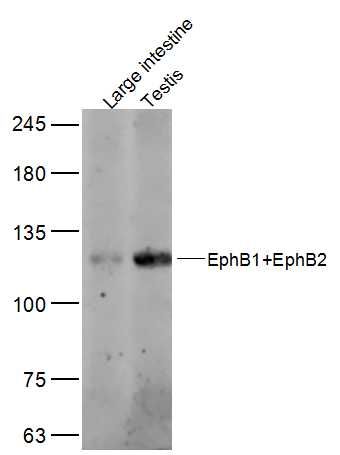 EphB1+EphB2酪氨酸蛋白激酶受体B1+B2抗体