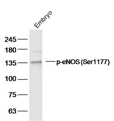 Phospho-eNOS (Ser1177) antibod