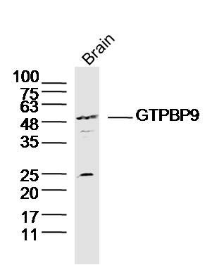 GTPBP9 antibody