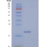 人CD99抗原样蛋白2/CD99L2重组蛋白C-6His