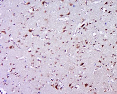 ZNF502锌指蛋白502抗体