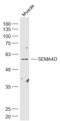 SEMA4D antibody