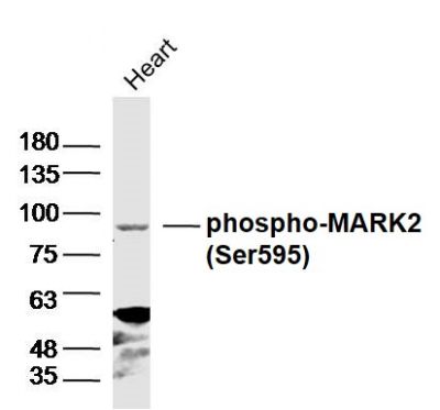 phospho-MARK2(Thr596)磷酸化丝氨酸/苏氨