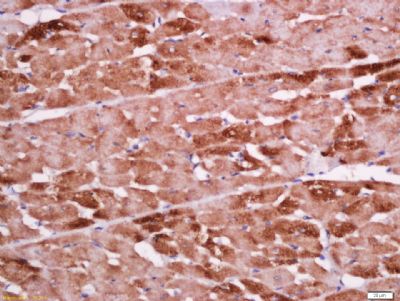 Cardiac Troponin T心肌特异性肌钙蛋白T抗体