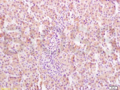 Growth hormone receptor antibo
