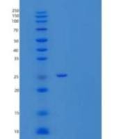 大鼠t淋巴细胞活化抗原CD86重组蛋白