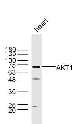 AKT1蛋白激酶B抗体
